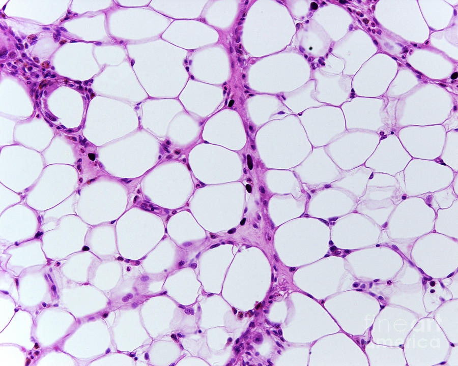 <p>What type of connective tissue is shown in the image?</p>