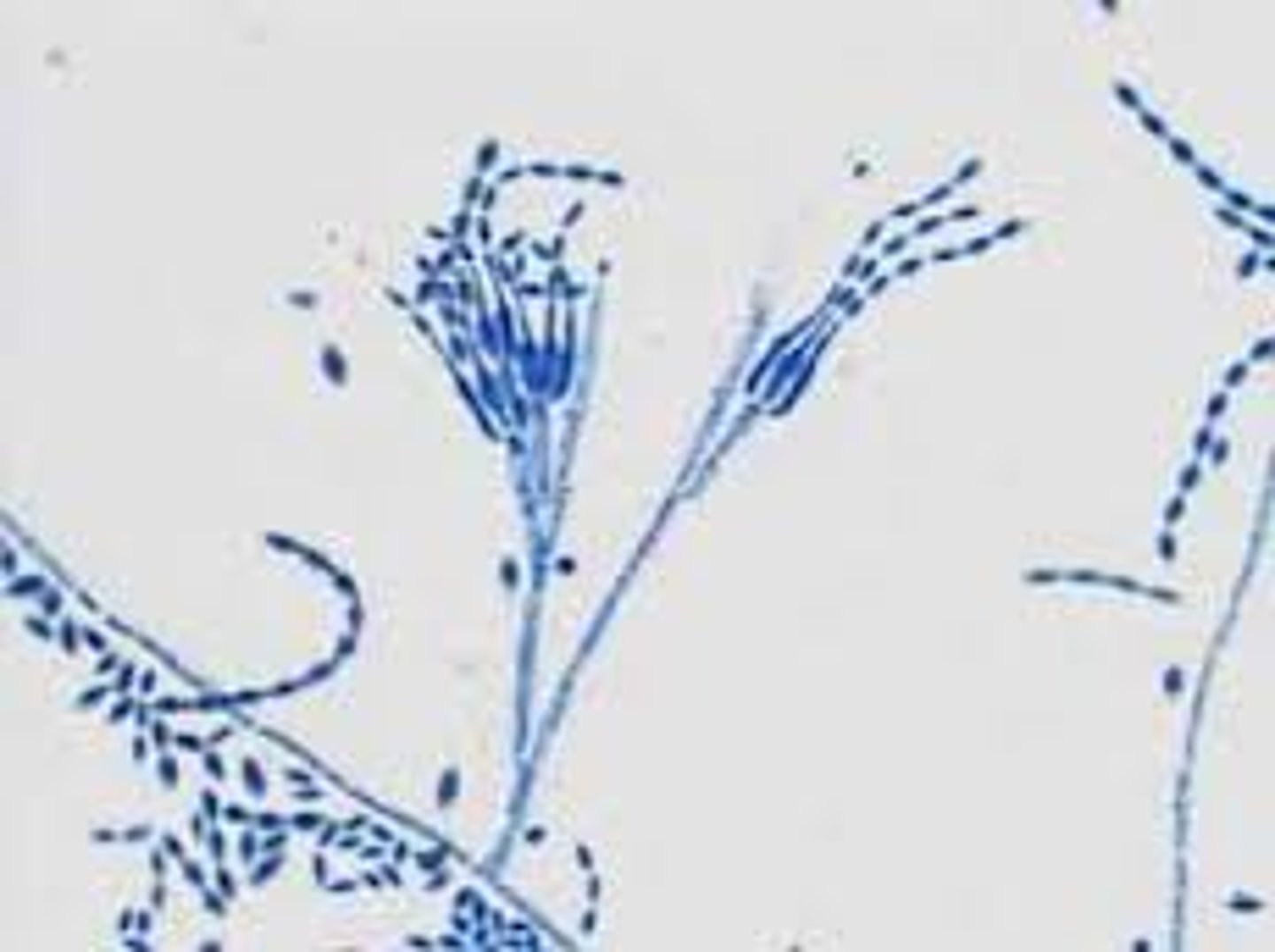 <p>rapid</p><p>Powdery, velvety-white, becomes olive tan or pink</p><p>Reverse: colorless</p><p>Microscopic: elongated phialides have chains of oval conidia</p><p>Conditions: skin lesions and endocarditis</p>