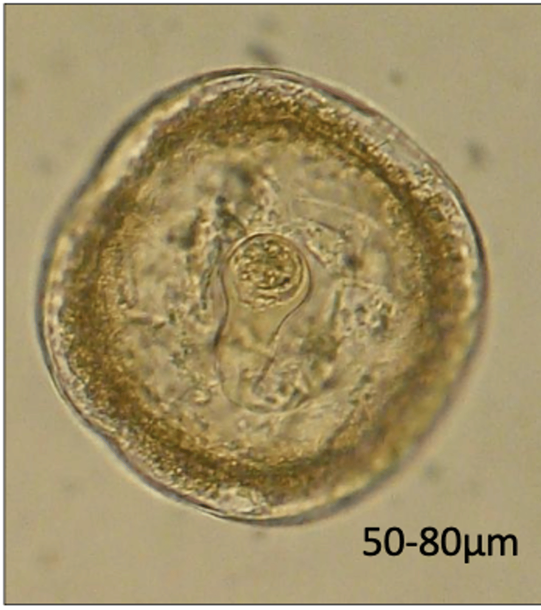 <p>Found in a horse with spasmodic colic which lead to intussusception of the ileum. What parasite does this egg belong to?</p>