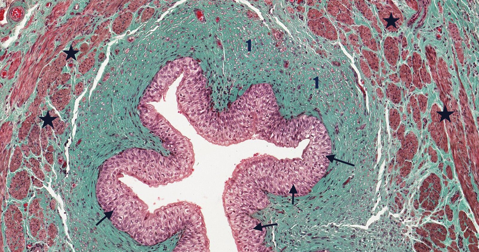 <p>14. Which statement about the histological image is correct?</p><p>A. The arrows point to the stratum granulosum.</p><p>B. The numbers 1 mark a zone with mucous glands.</p><p>C. The stars mark the adventitia of the organ shown.</p><p>D. The section shown contains plicae circulares.</p><p>E. The superficial cell layer of the epithelium contains uroplakins.</p>