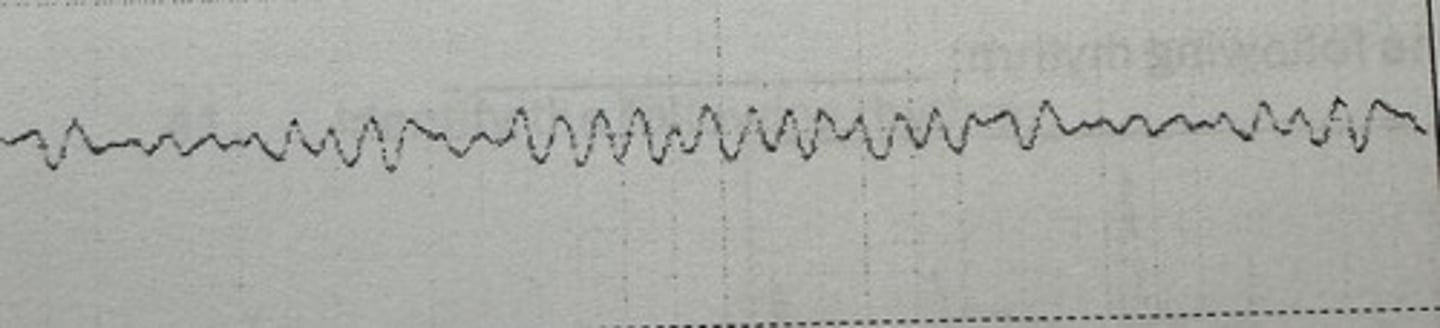 <p>identify the rhythm</p>