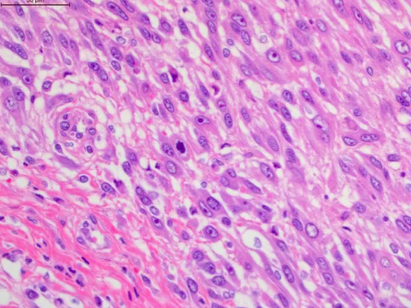 <p>Identify the pathology:</p>