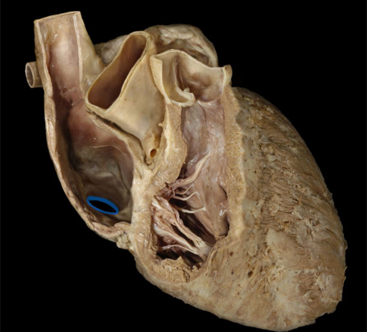 knowt flashcard image