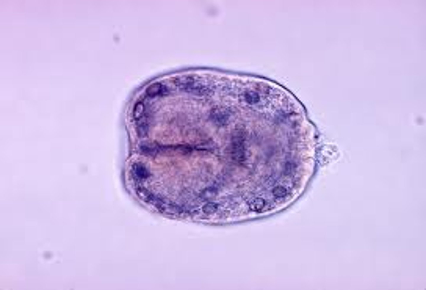 <p>30-38um</p><p>Resembles Taenia eggs</p>