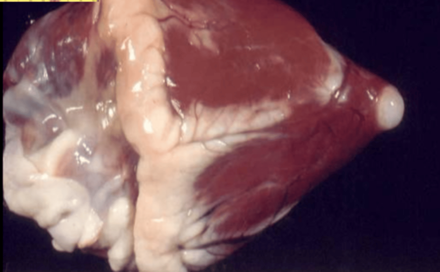 <p>what do we see on this heart?</p>