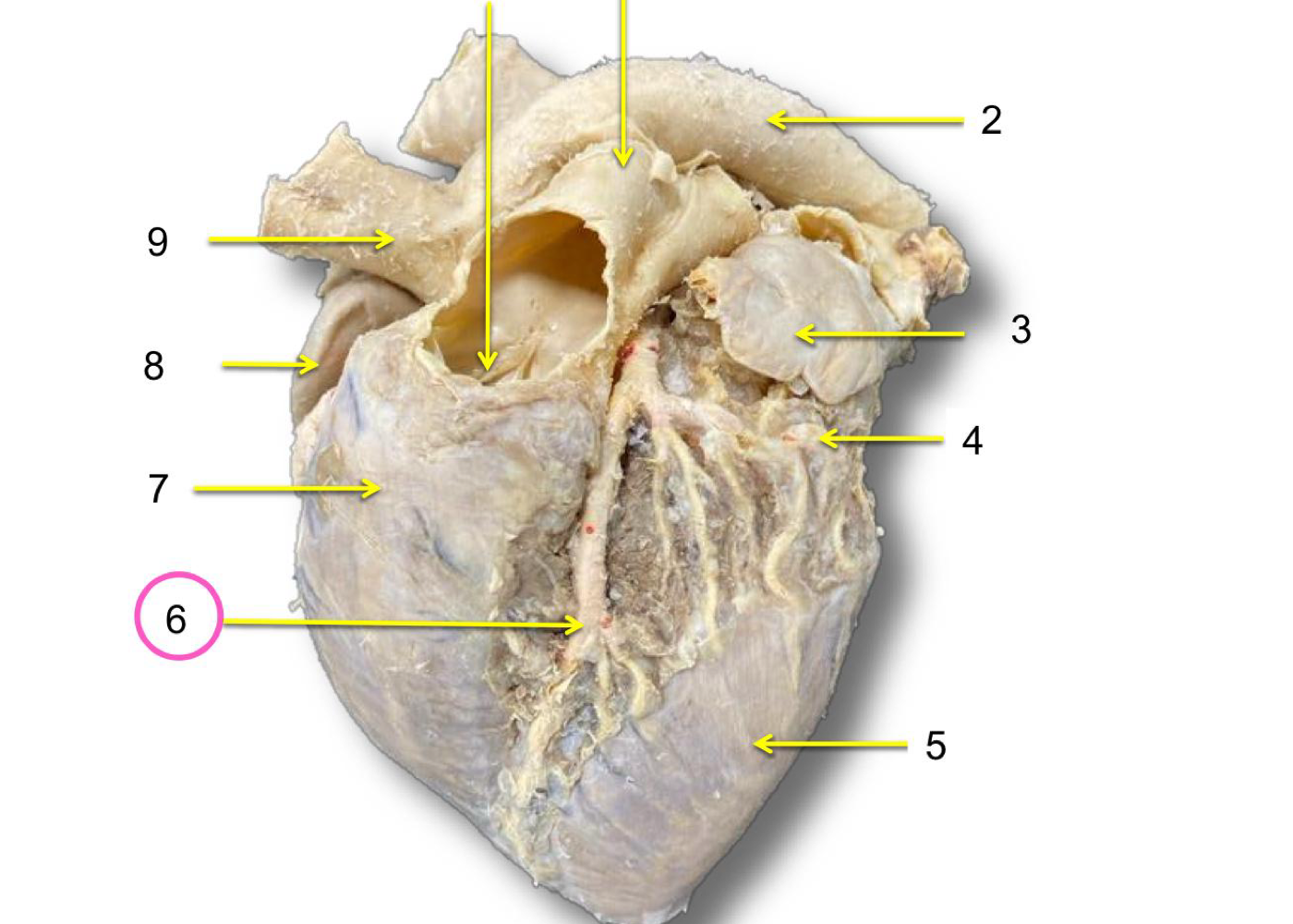 <p>What is the following artery/vein on #6</p>