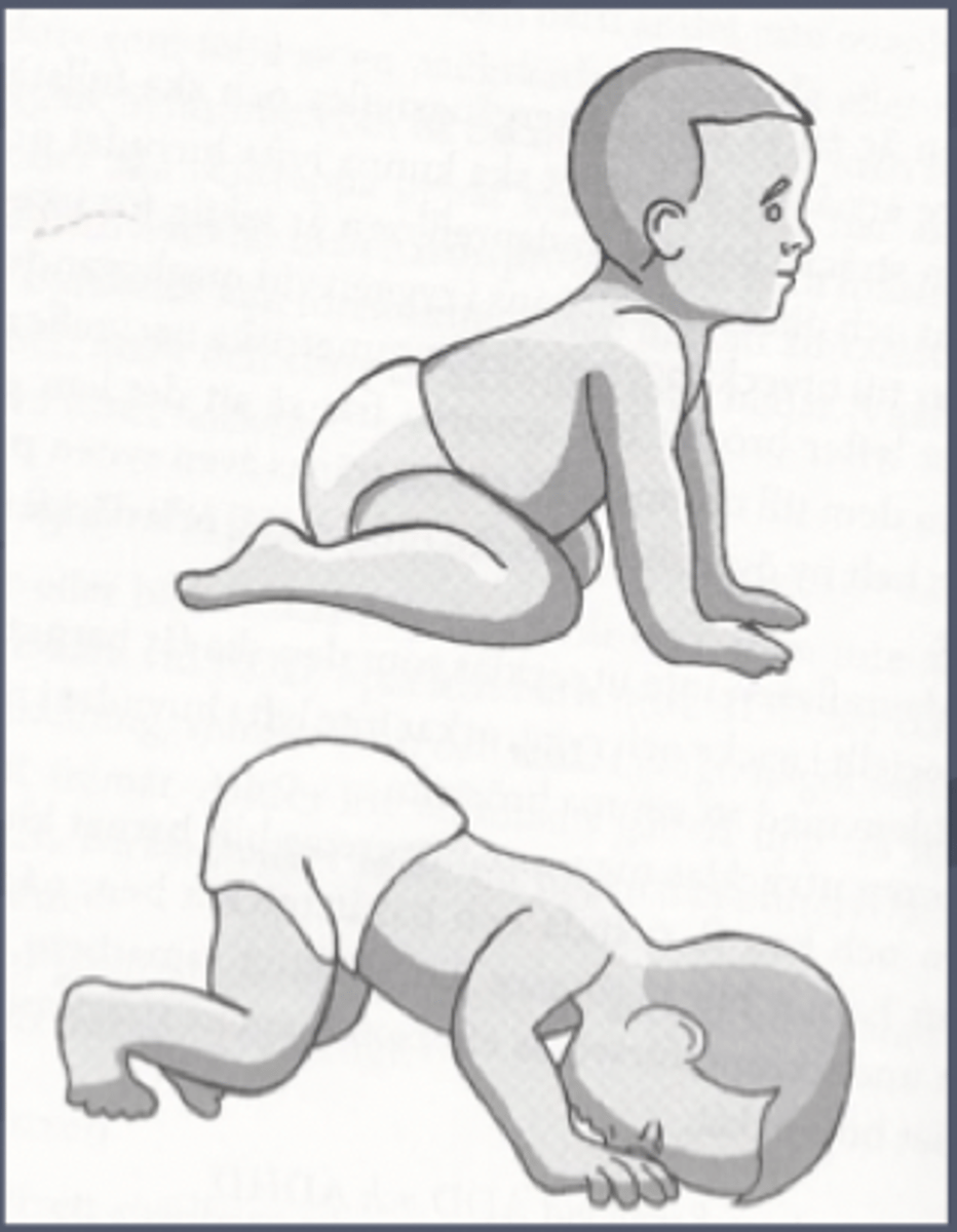 <p>- Position: quadruped (on all fours)</p><p>- With neck flexion: the UE flex and LE extend; with neck extension: the UE extend and LE flex</p><p>- Integration: 8 to 12 months</p><p>- onset: 4-6 months</p>