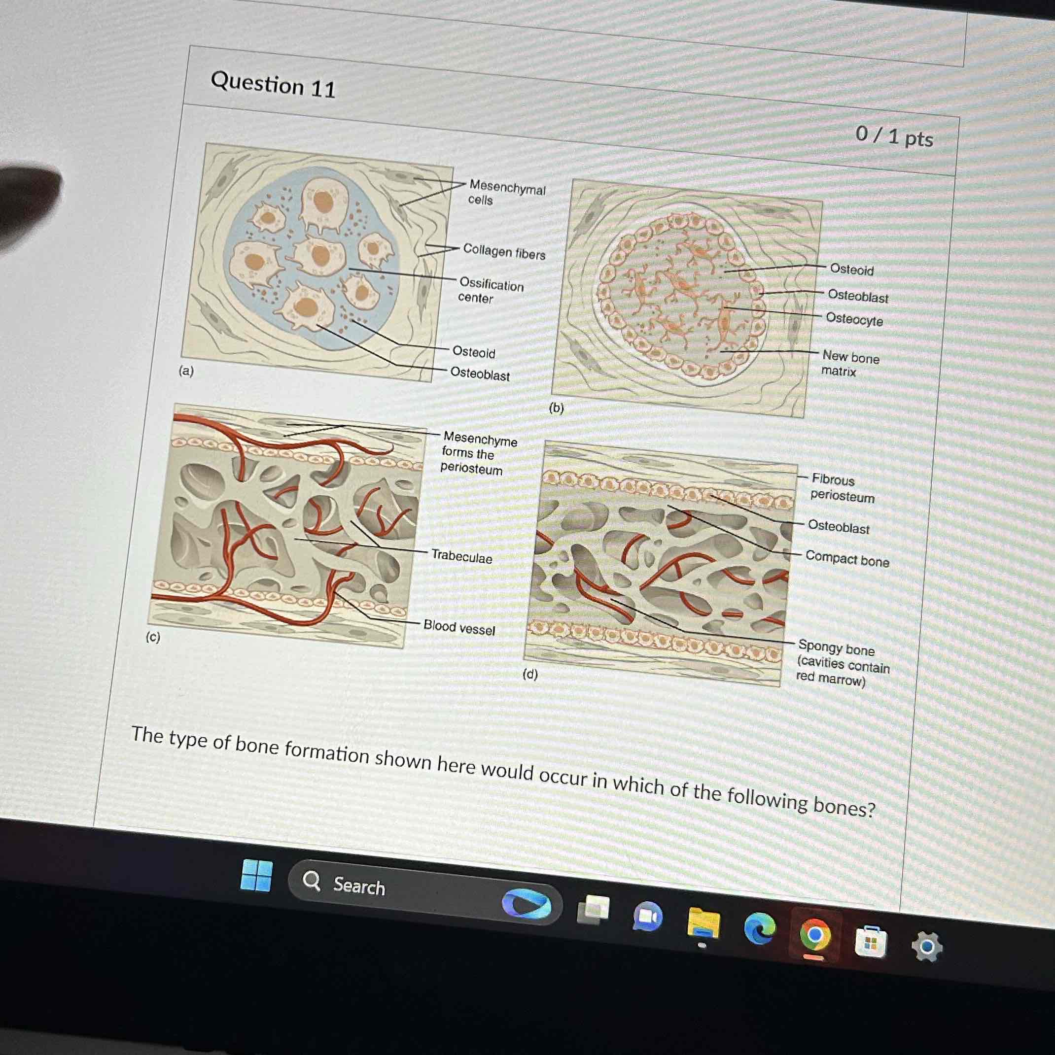 <p>This type of bone formation shown here would occur in which of the following bones</p>
