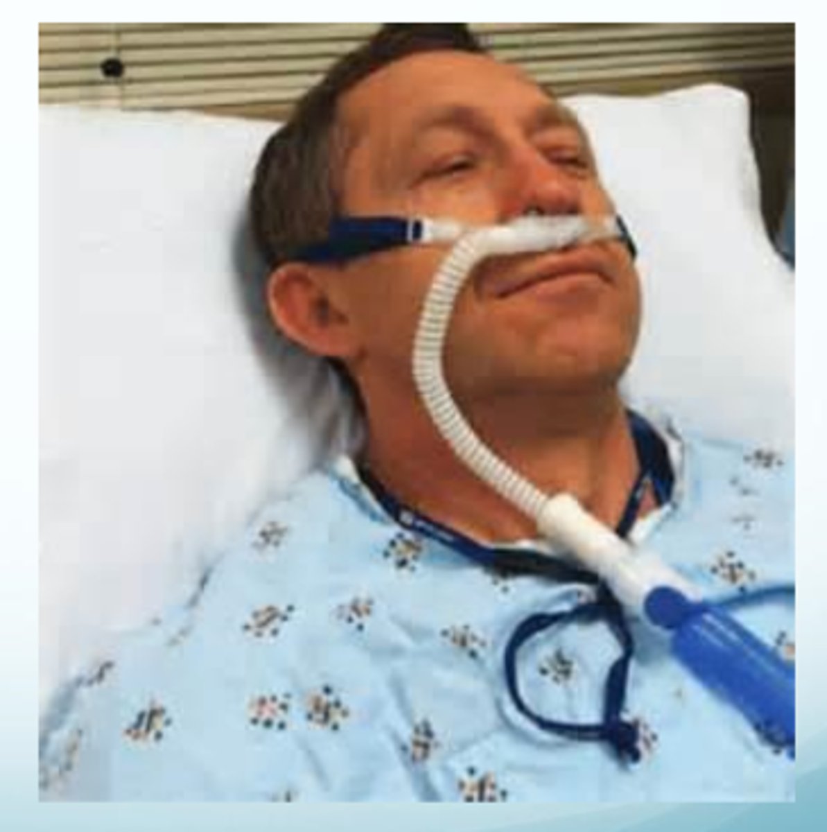 <p>Continuous delivery of air/oxygen through a heater/humidifier</p><p>• 10L/minute = 65% oxygen</p><p>• 15L/minute = 90% oxygen</p><p>Wide bore nasal canula</p><p>Maintains a small amount of continuous positive pressure during the breathing cycle</p><p>Patients with mild to moderate respiratory failure (avoiding invasive mechanical ventilation)</p><p>Close monitoring to avoid delay if airway intervention needed</p>