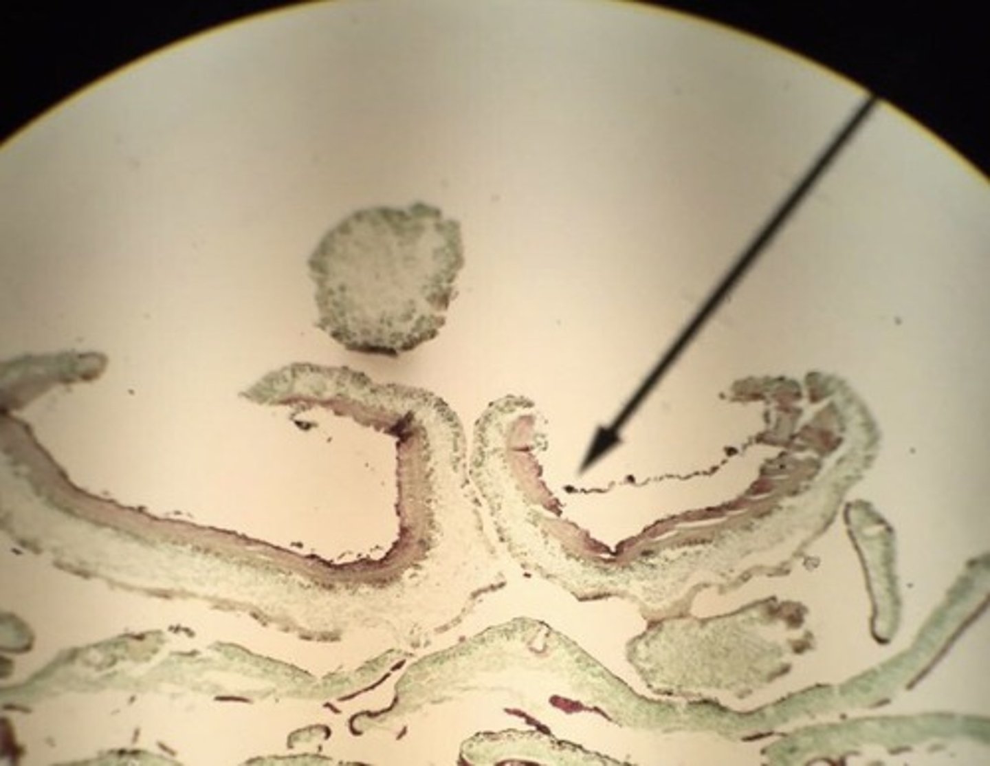 <p>cup like fungus that has asci lining the upper surface; ascomycotina</p>