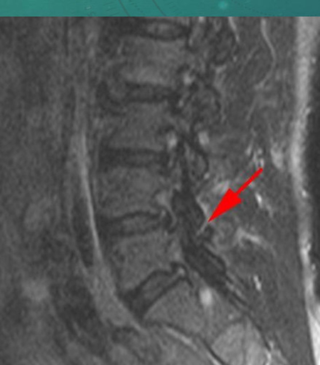 <p>What anomaly is this?</p>