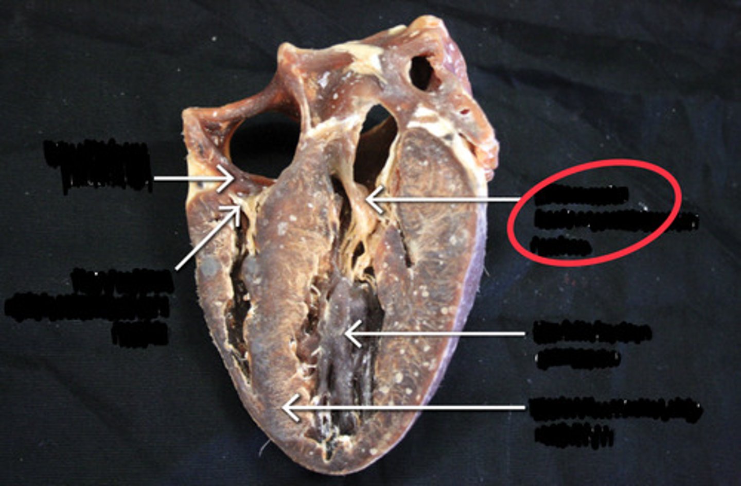 <p>identify the valve</p>