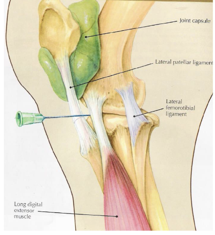 <p>what is desensitized with a lateral femorotibial joint block</p>