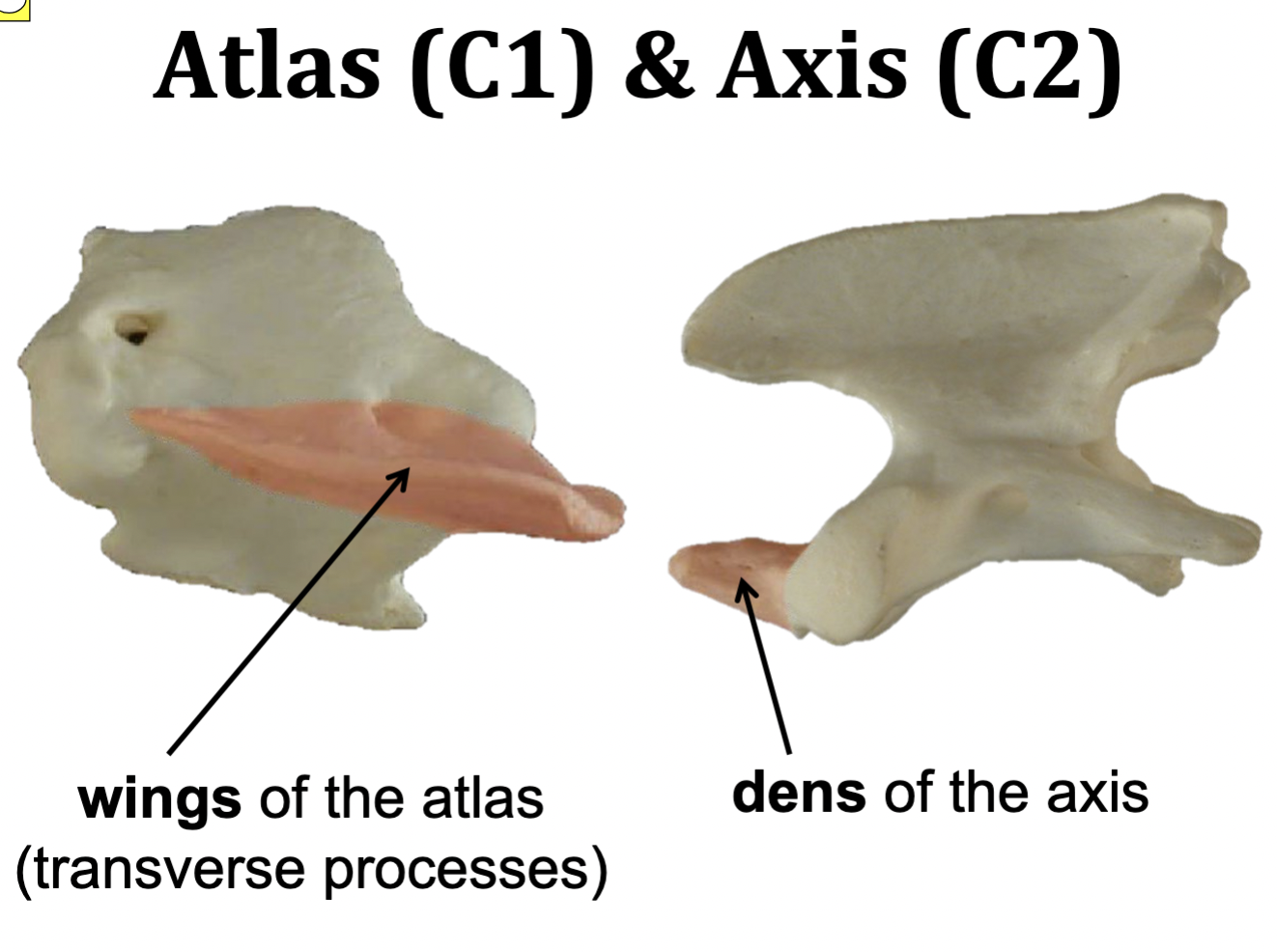 <p>Atlas = C1<br>Axis = C2</p>