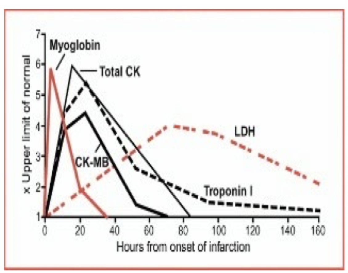 <p>What is the 1st cardiac <u>enzyme</u> to rise?</p>