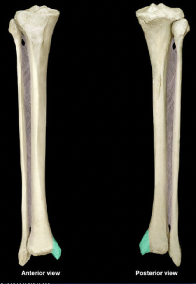 <p>Medial malleolus </p>