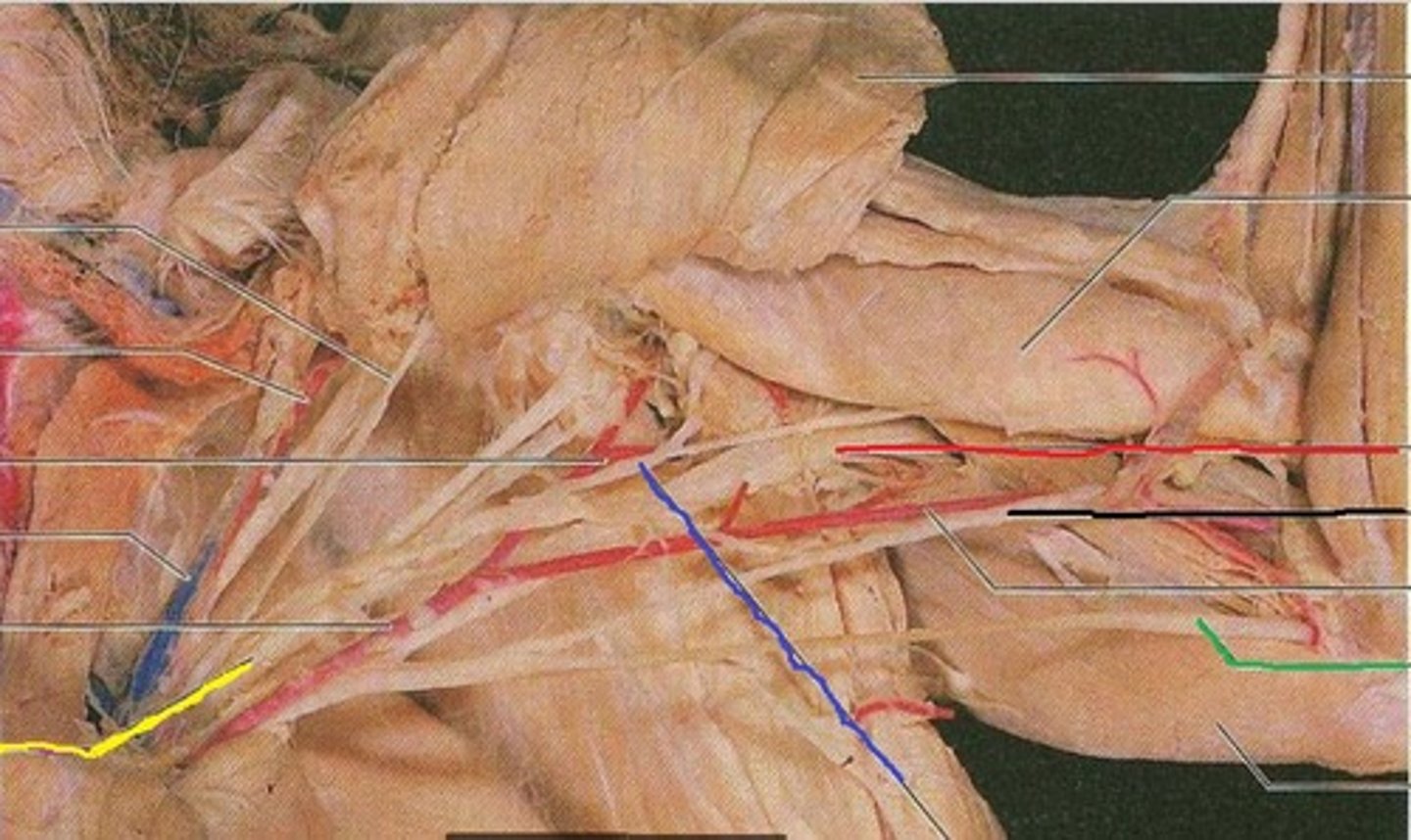 <p>To what nerve is the black line pointing?</p>