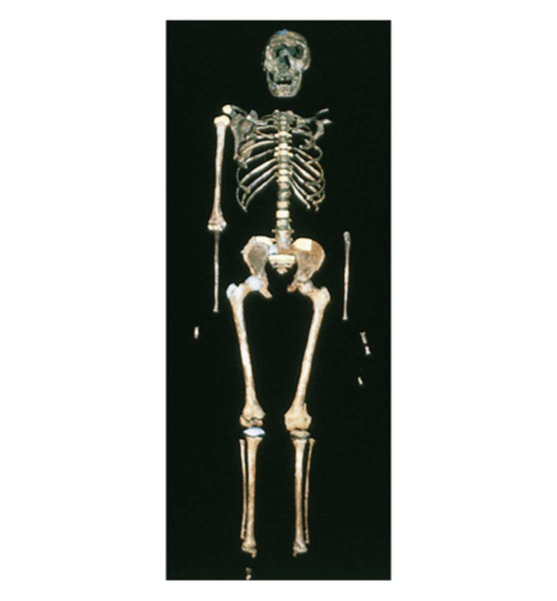 <p>-11 to 15yr old male specimen found with nearly complete skeleton, gave postcranial body plan of H. erectus</p><p>-shows huge increase in body size from late Au. and H. habilis</p>