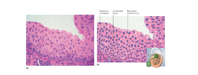 <p>Urothelium (transitional epithelium)</p>