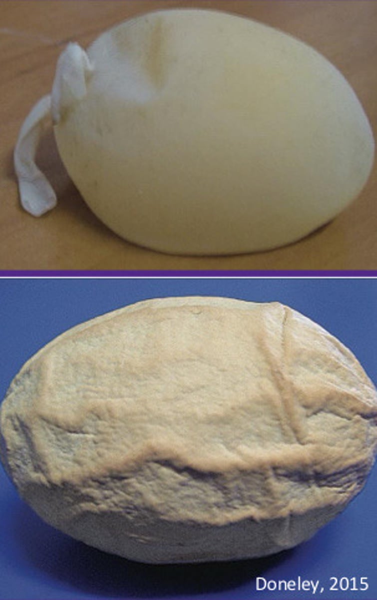 <p>Reproductive disease (egg bound/dystocia, salpingitis, and metritis)</p><p>Signs?</p><p>Dx/BW abnormalities?</p>