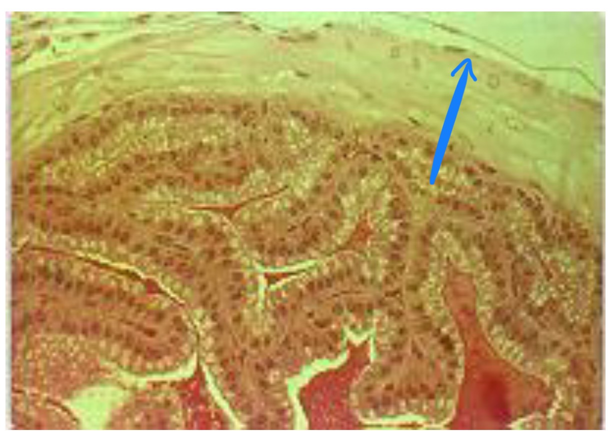 term image