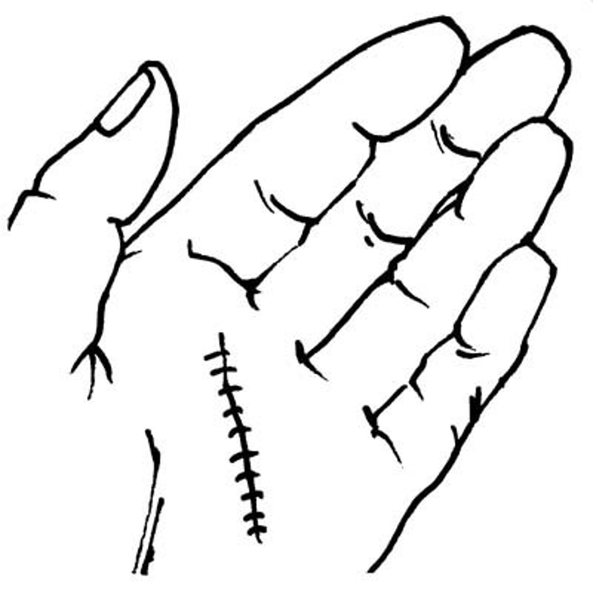 <p>stitches</p>