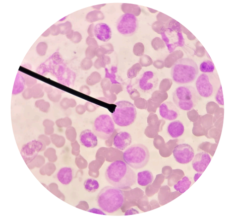 <p>what kind of white blood cells is this?</p>