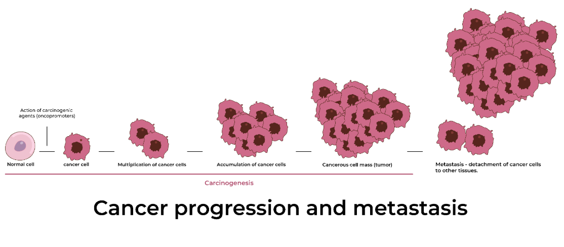 <p><span>The process of cancer cells breaking away from the original (primary) tumor and establishing another (secondary) tumor elsewhere in the body</span></p>
