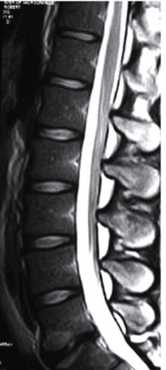 <p>what type of imaging is this?</p><p>a. T2 MRI</p><p>b. CT Scan</p><p>c. Radiograph</p><p>d. T1 MRI</p>