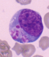 <p>What type of lymphocyte is this?</p>
