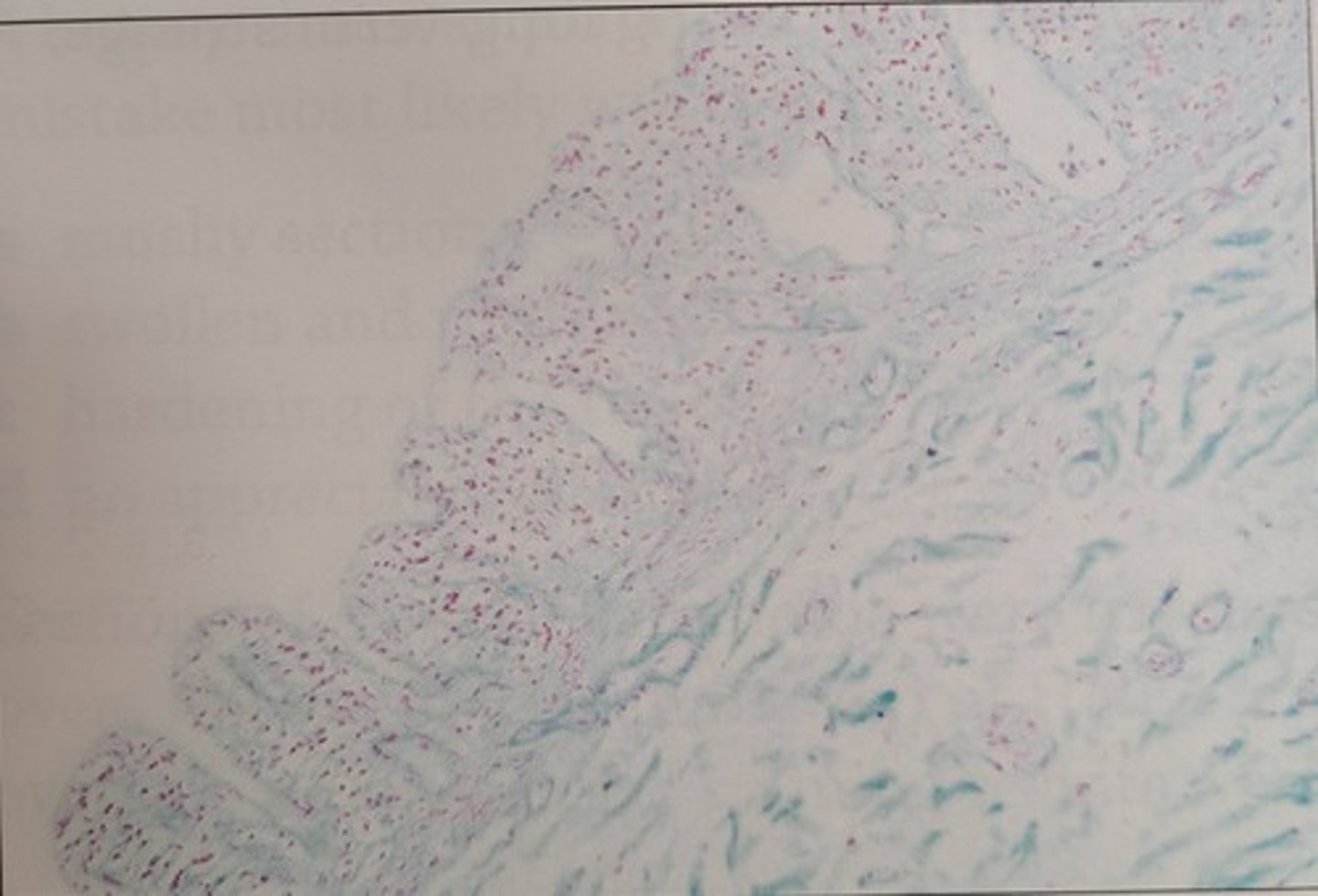 <p>b. immediate contact with fixative solution</p><p>- Some of the epithelium is gone in this section, indicating that there was a slight delay in fixation. GI specimens should be opened, pinned out, and placed in fixative as soon after interruption of the blood supply as possible</p>
