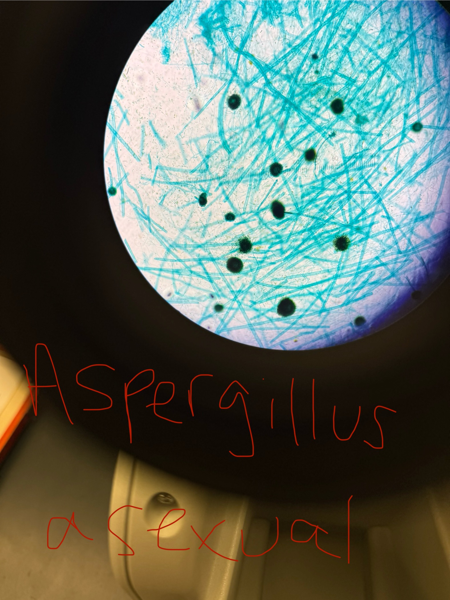 <p>Aspergillus niger</p>