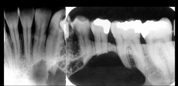 <p>most likely diagnosis?</p>