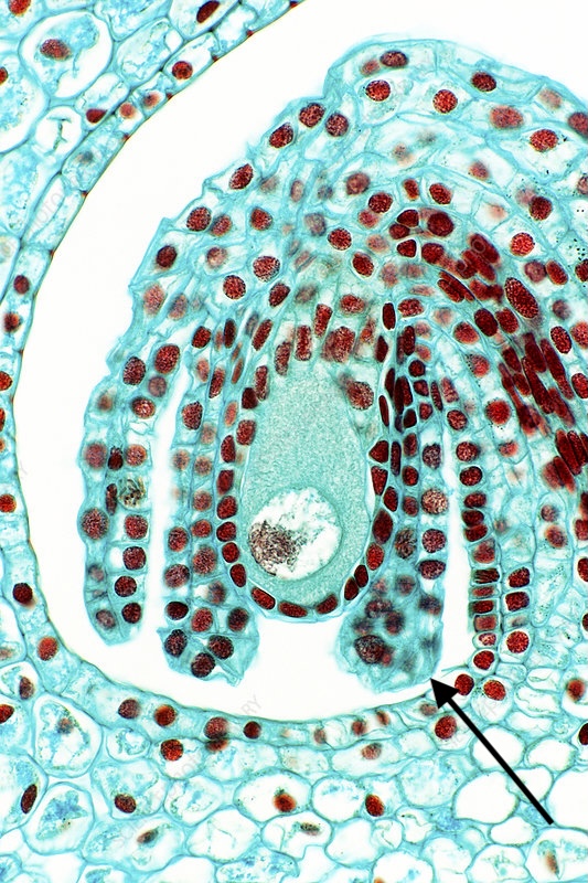 <p>(click on the picture to see the arrow)</p>