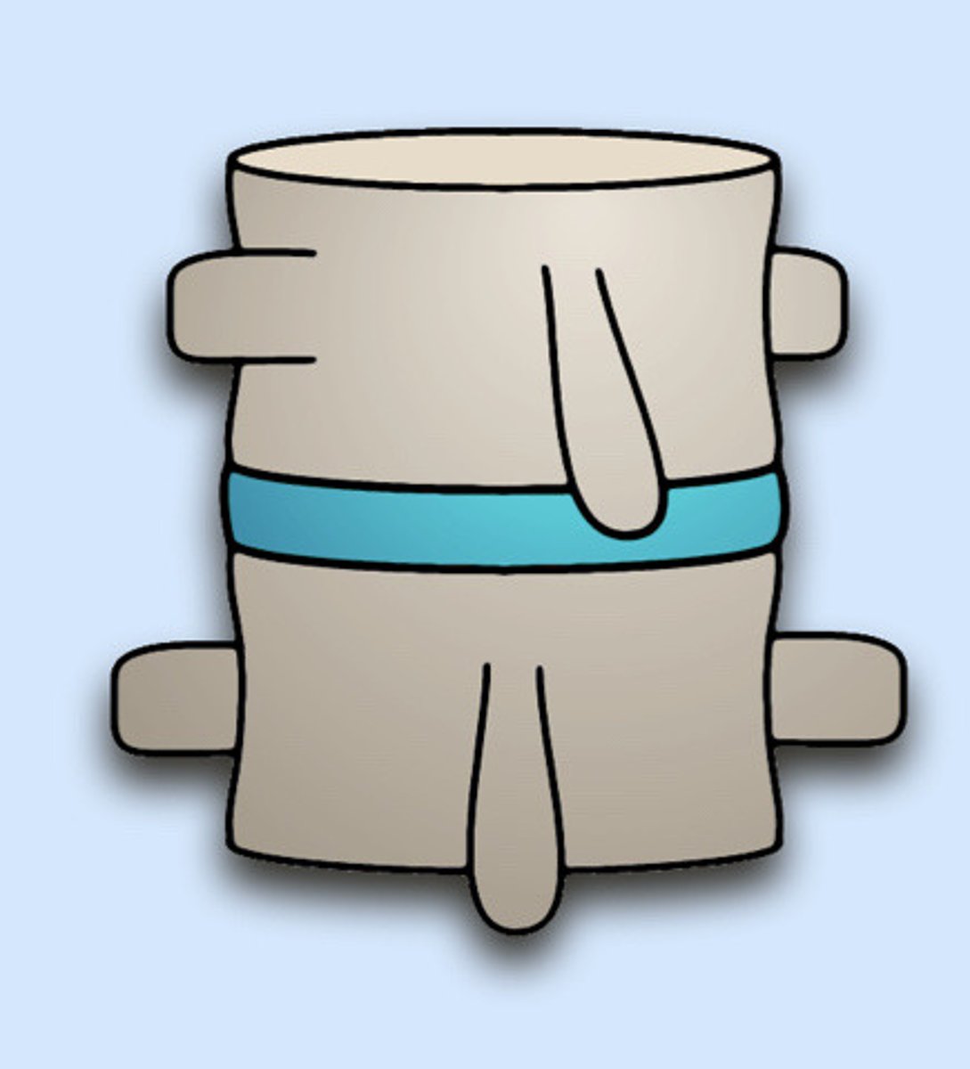 <p>Static listing</p>