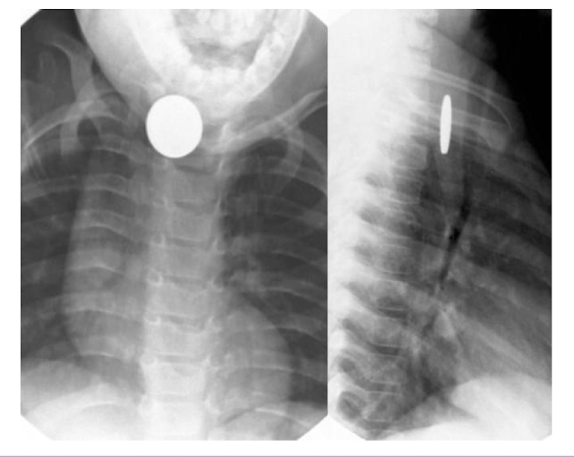 <p>What is shown on the pediatric imaging?</p>