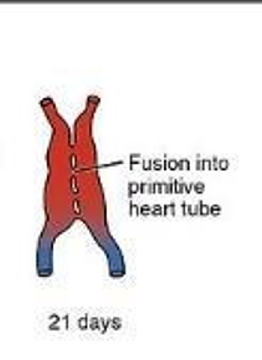 <p>The initial structure of the heart formed by the fusion of two heart tubes during embryonic development.</p>