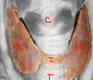 <p>R/L lobes best palpated by finding laryngeal prominence, move inferiorly to cricoid cartilage</p><p>Move posteriolateral to larynx</p><p>Isthmus lies on surface of trachea</p><p>Palpate isthmus by finding cricoid cartilage, move inferiorly to palpate along trachea</p>