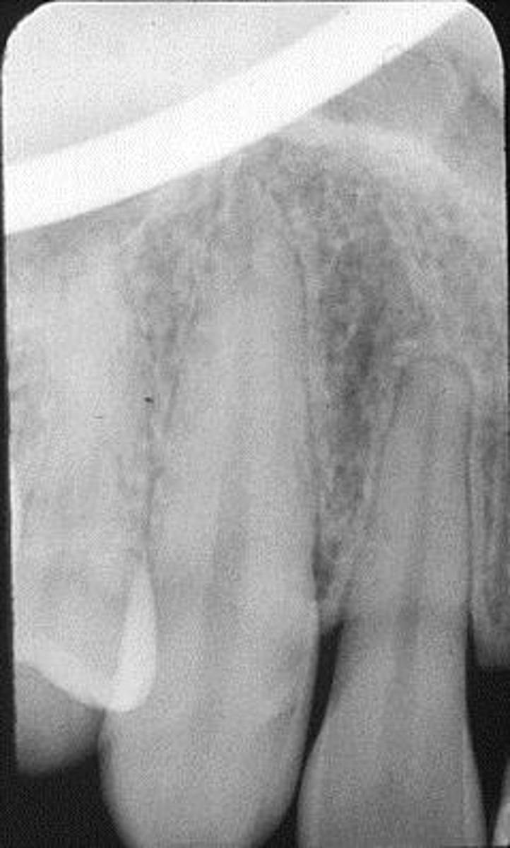 <p>What is his error?</p>