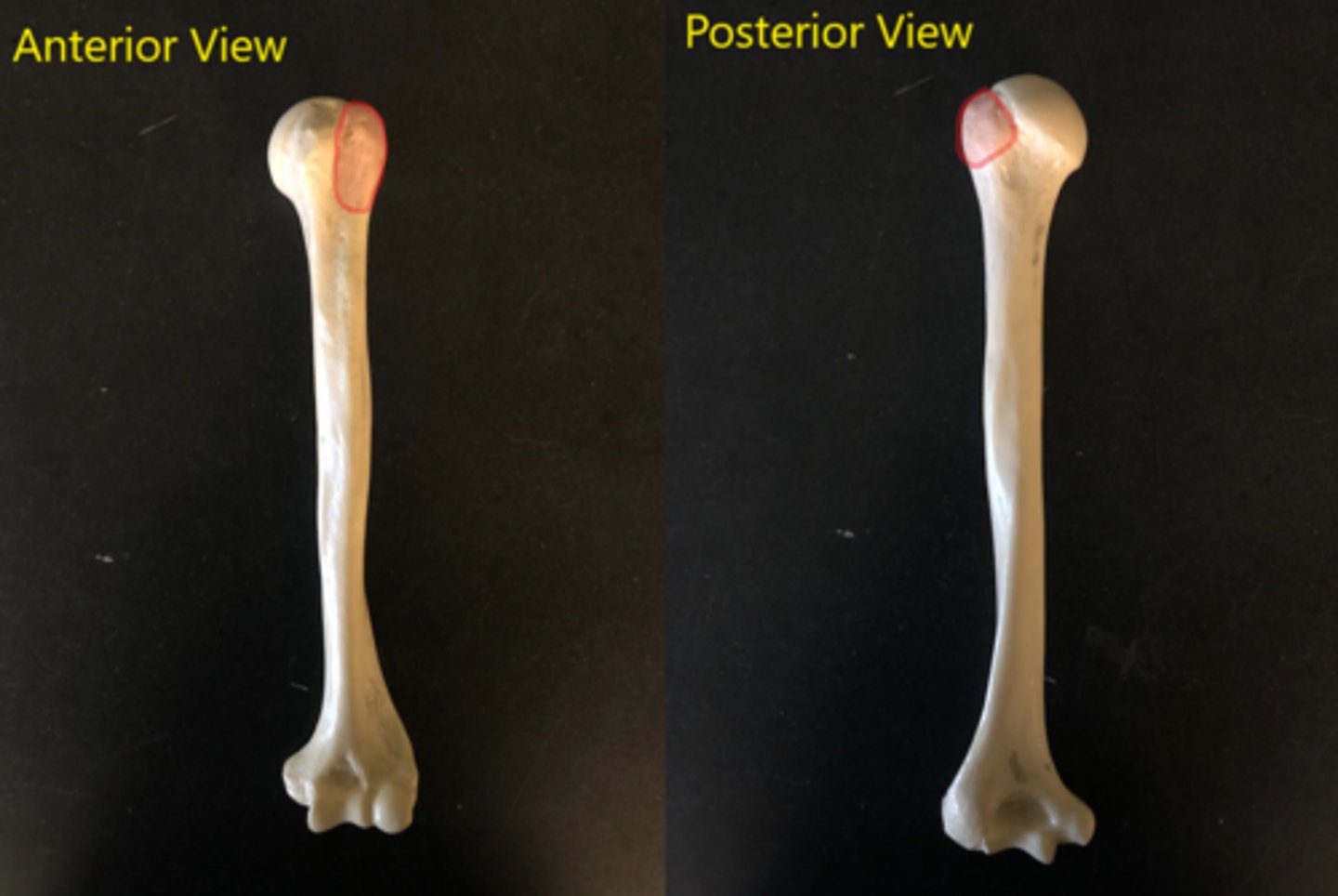 <p>Top portion of hump, right next to head (laterally)</p>