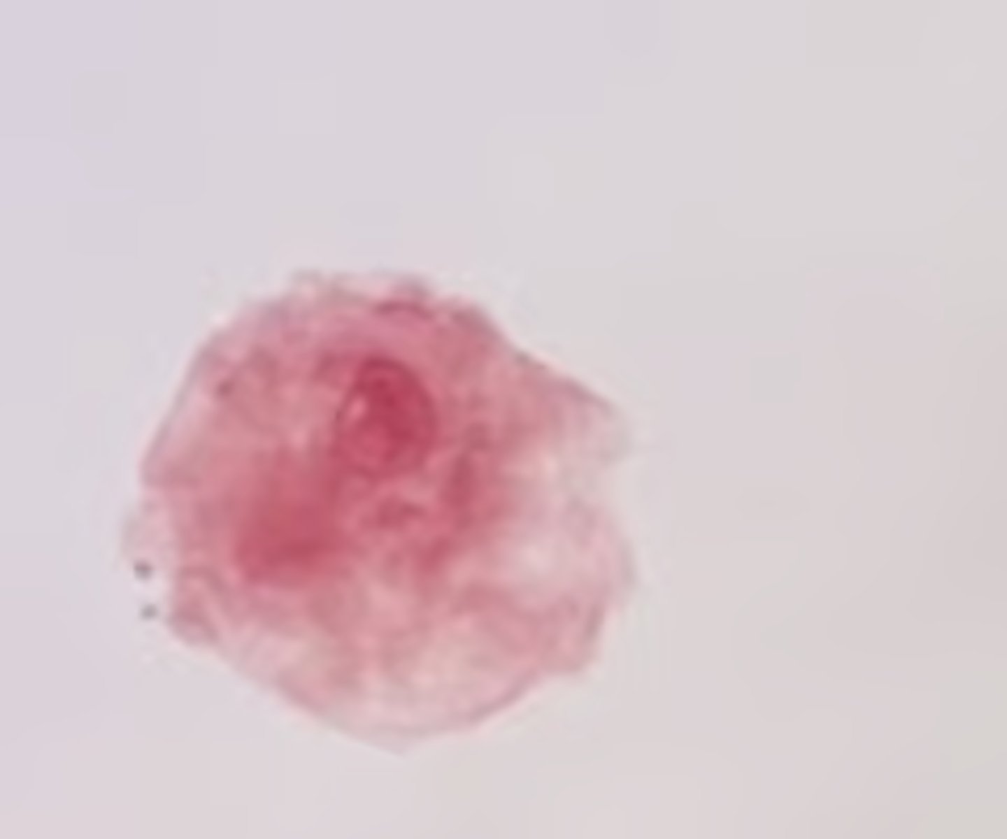 <p>Irregular shape, pseudopods for movement</p>