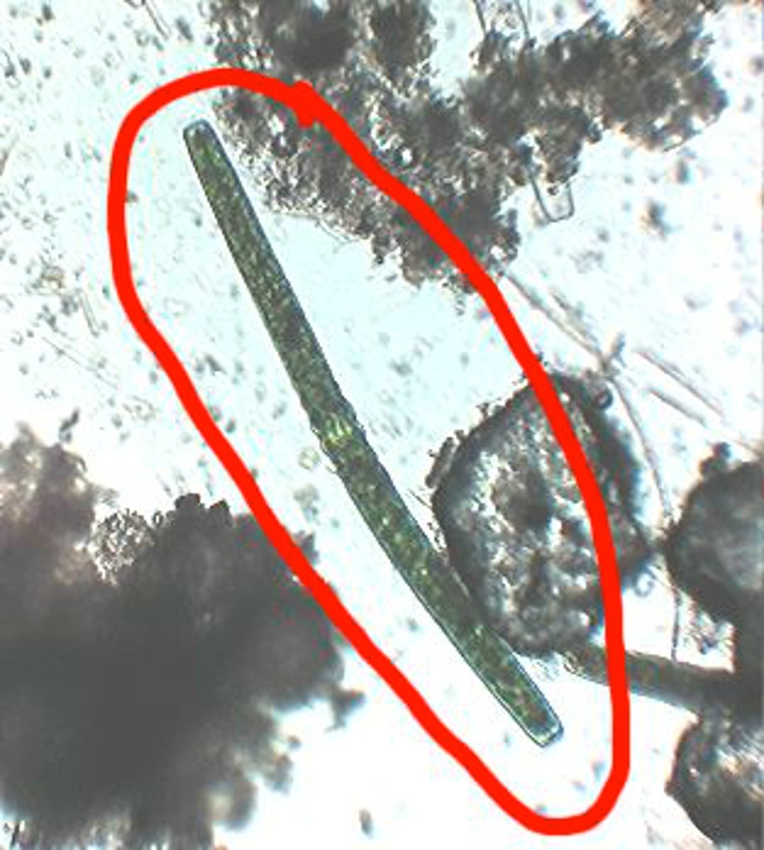 <p>Identify the freshwater phytoplankton shown</p>