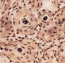 <p>Connective tissue composed of cells and an organic-inorganic extracellular matrix.</p>