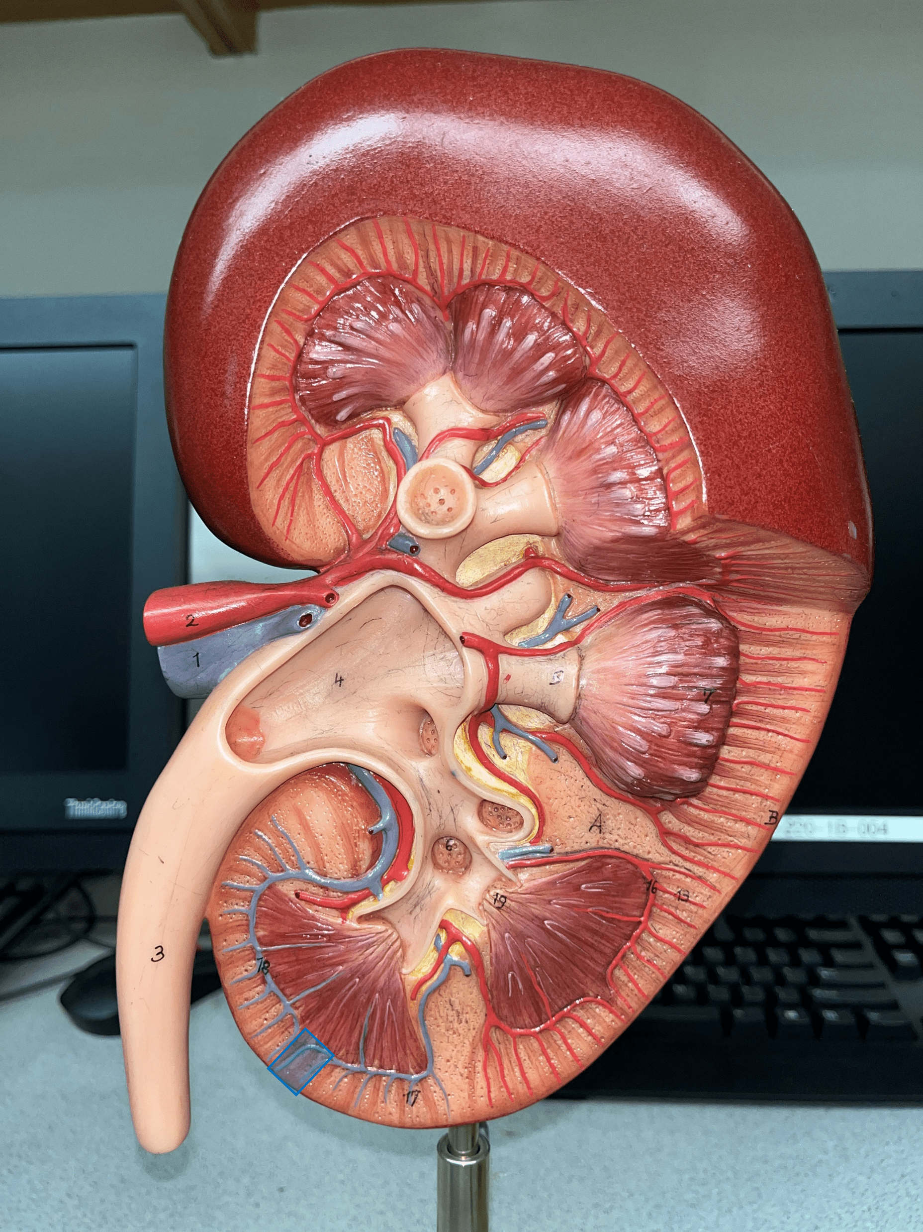 • Extends through the renal cortex.

• Converges into an arcuate v.