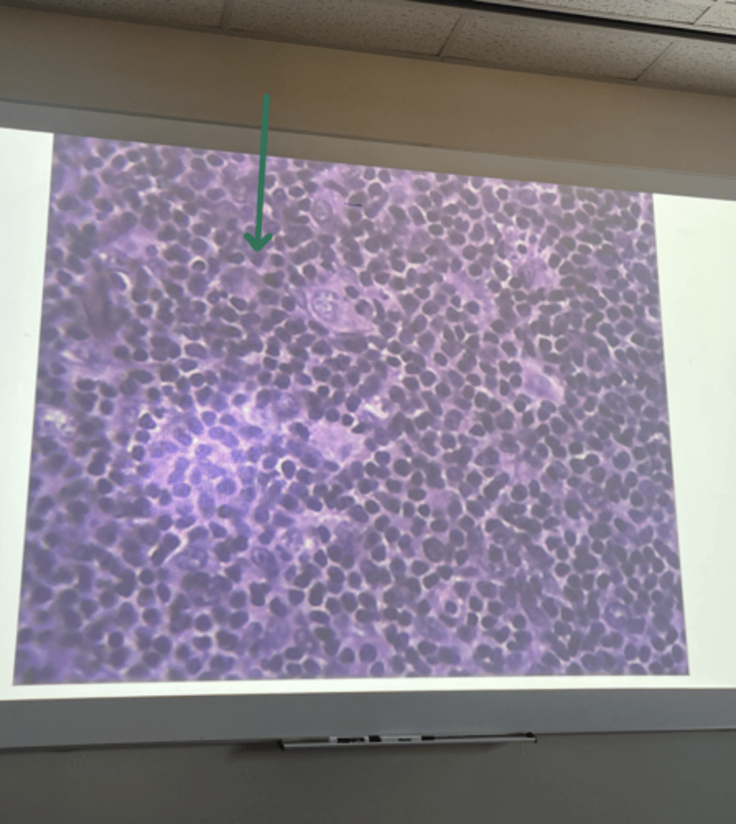 <p>gland and structure</p>