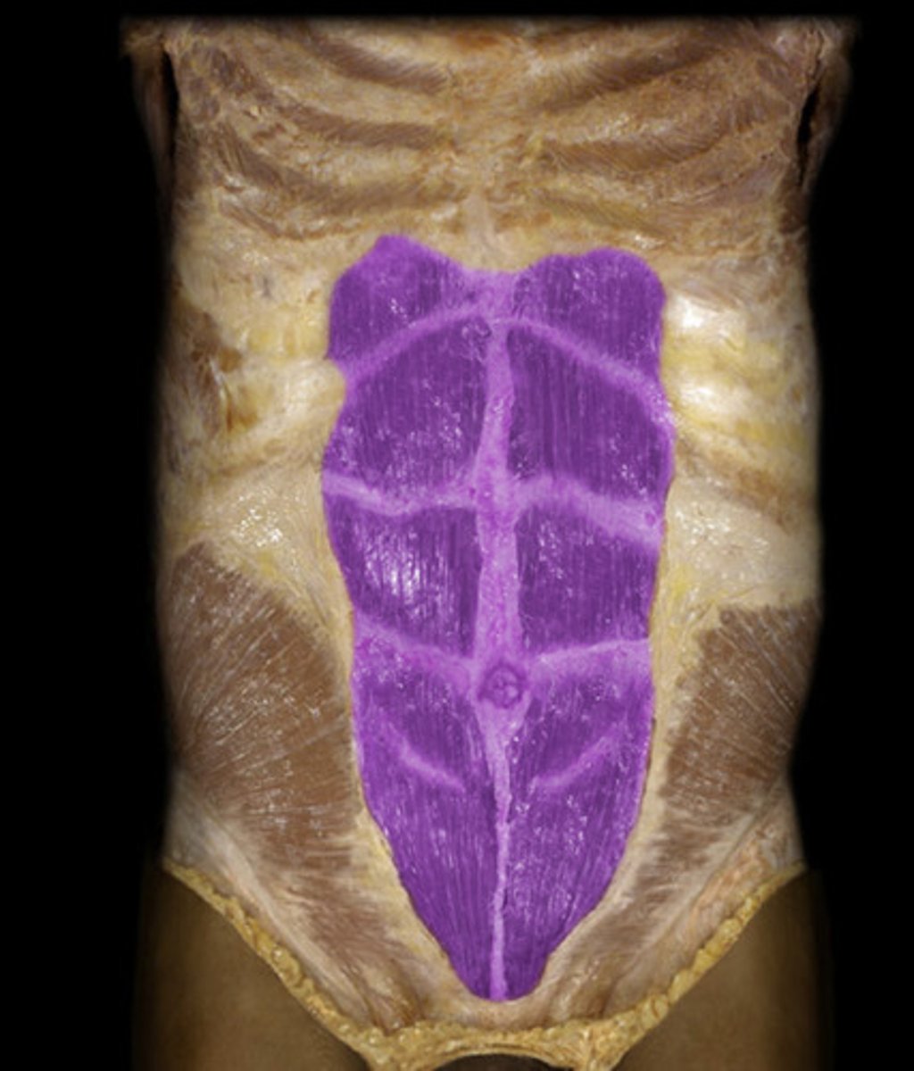 <p>rectus abdominis</p>