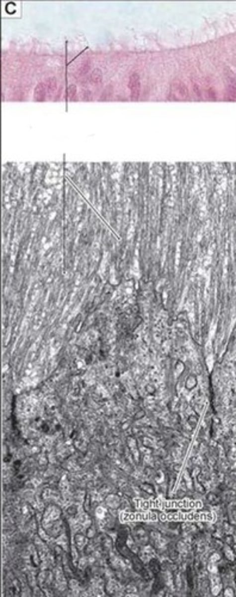 <p>What apical surface projection is this?</p>