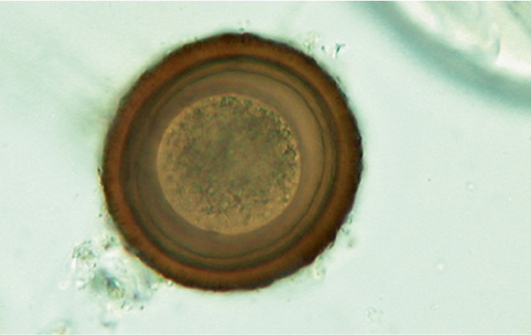 <p>This parasite was found in a foal. Please name the parasite.</p>