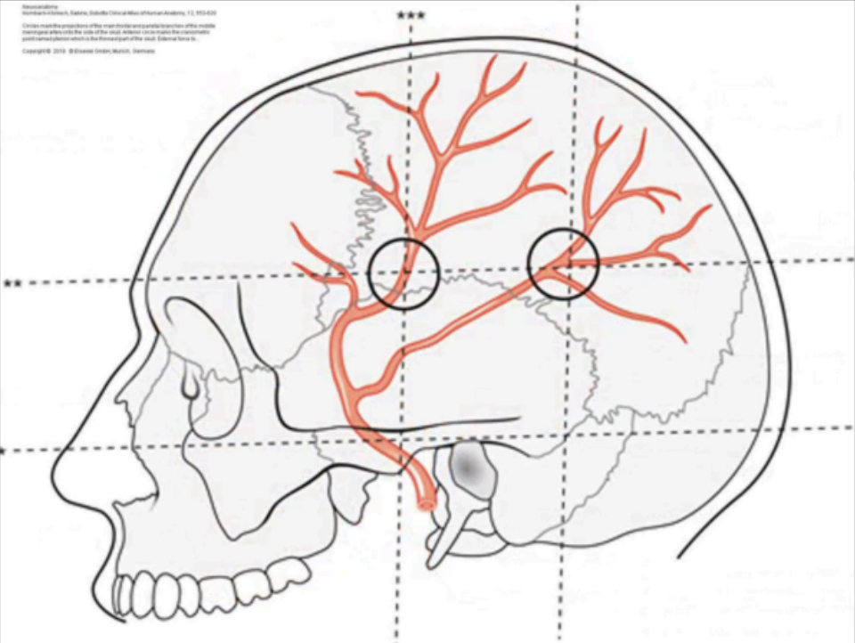 <p>Middle meningeal artery</p>