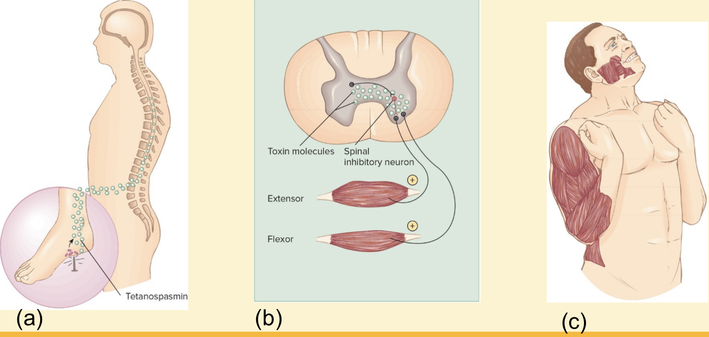 <p></p><ul><li><p>Neurotoxin released by C. tetani causes paralysis by binding to motor nerve endings</p></li><li><p>blocking the release of neurotransmitter for muscular contraction inhibition</p></li><li><p>Muscles contract uncontrollably</p></li><li><p>Death is most often caused due to paralysis of the respiratory muscles</p></li></ul>